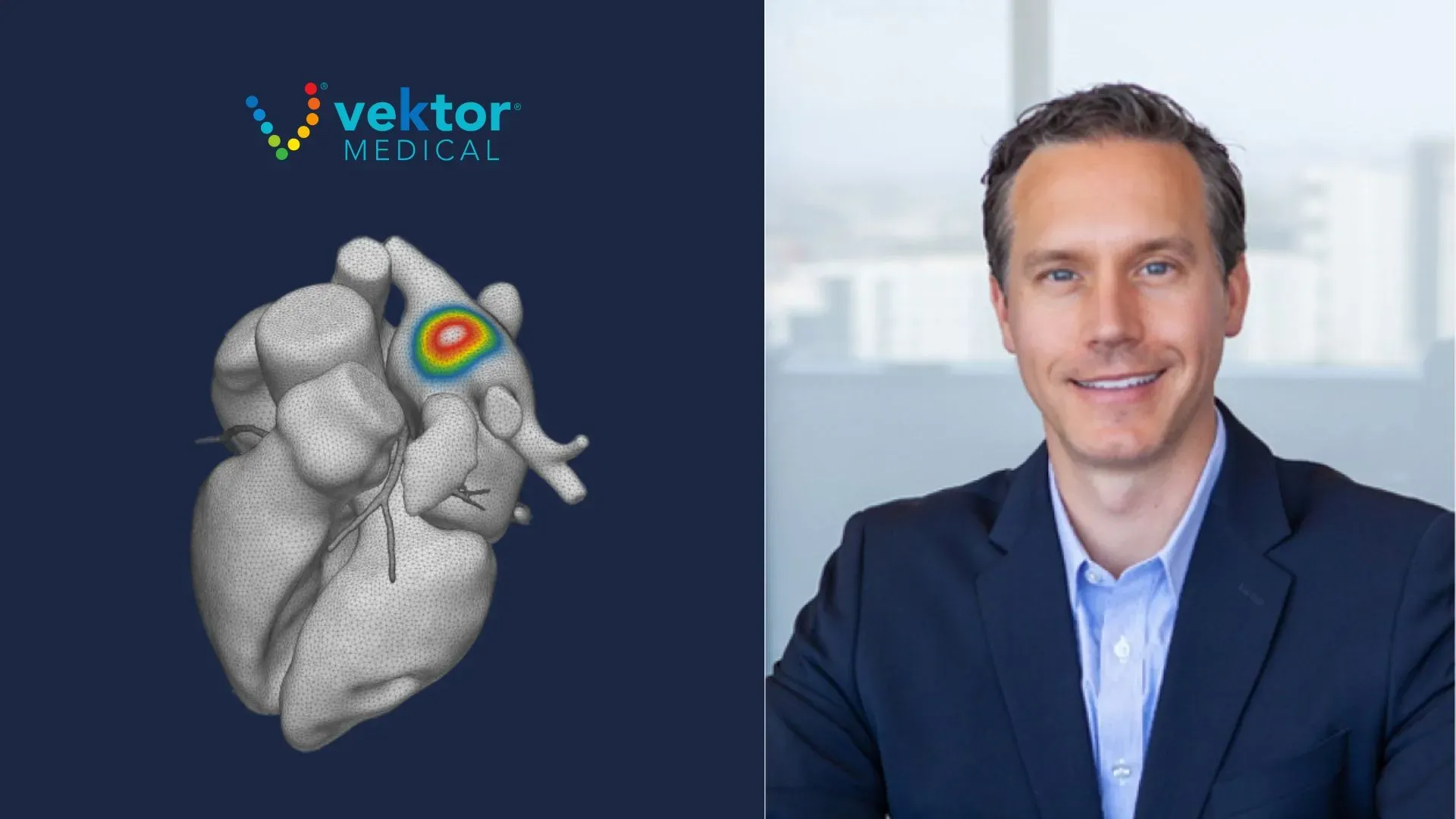 Vektor Medical Secures $16M Funding For AI-Led Arrhythmia Care Expansion