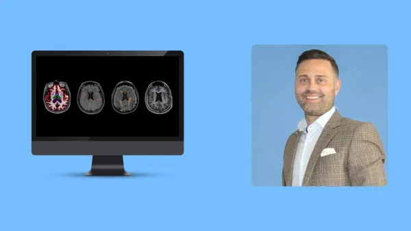 Cortechs.ai Welcomes Kyle Frye As CEO To Advance AI Radiology Innovations